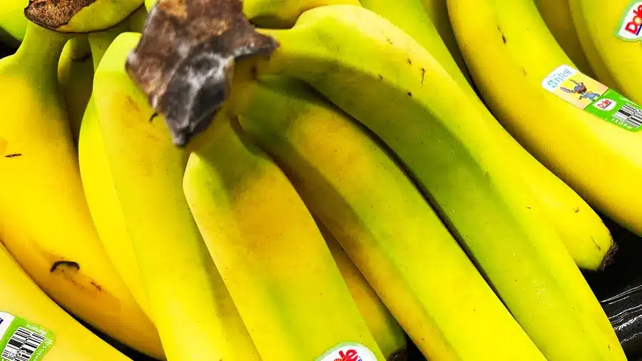 صورة من مقال: فرك الوجه بقشور الموز.. هل يعادل تأثير حقن البوتوكس؟